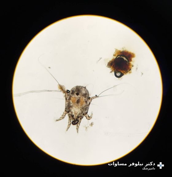 کنهٔ جرب گوش زیر میکروسکوپ